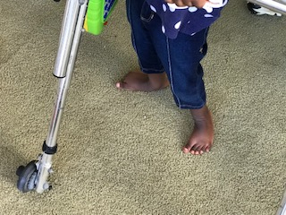 Adaptive Equipment